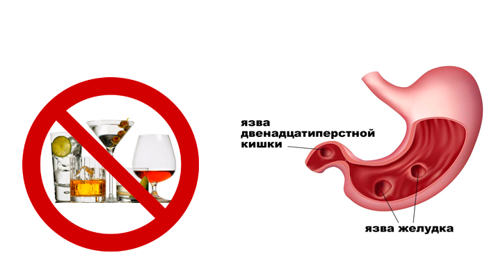 Влияние(вред) алкоголя на желудок