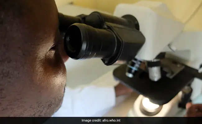 9 человек погибло в Гвинее из за смертельного вируса, похожего на Эболу!