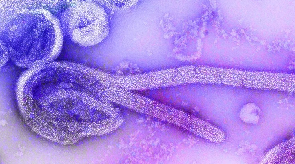 Что такое вирус Марбург: Симптомы и все остальное, что нужно знать о высокоинфекционном заболевании