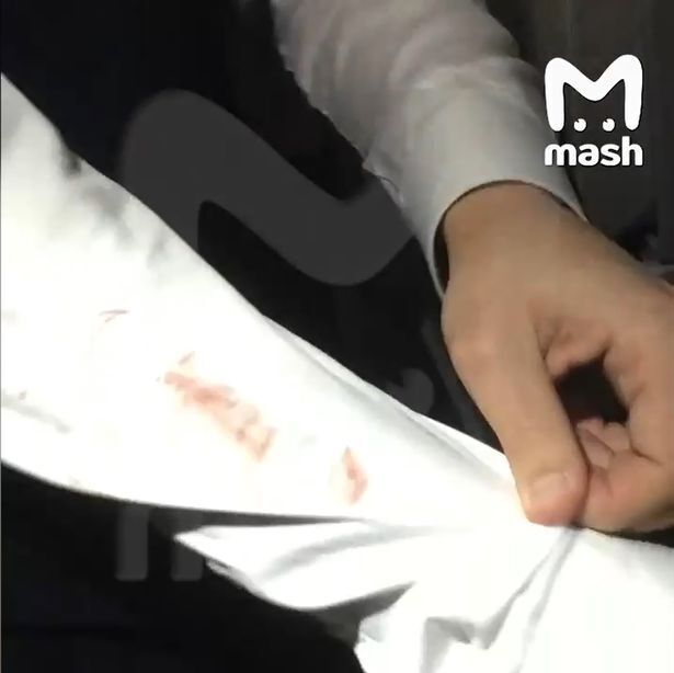 Пассажирка самолета топлесс укусила стюардессу перед попыткой проникнуть в кабину