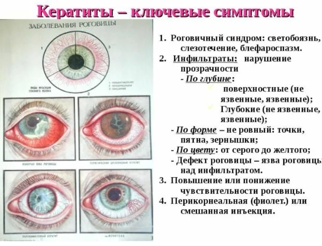 Заболевания глаз фото лечение