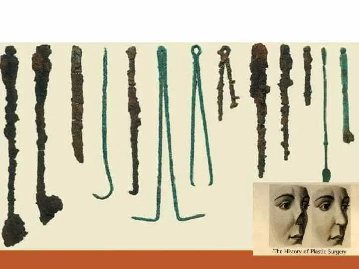 Что нашли в гробнице Друида из Колчестера?