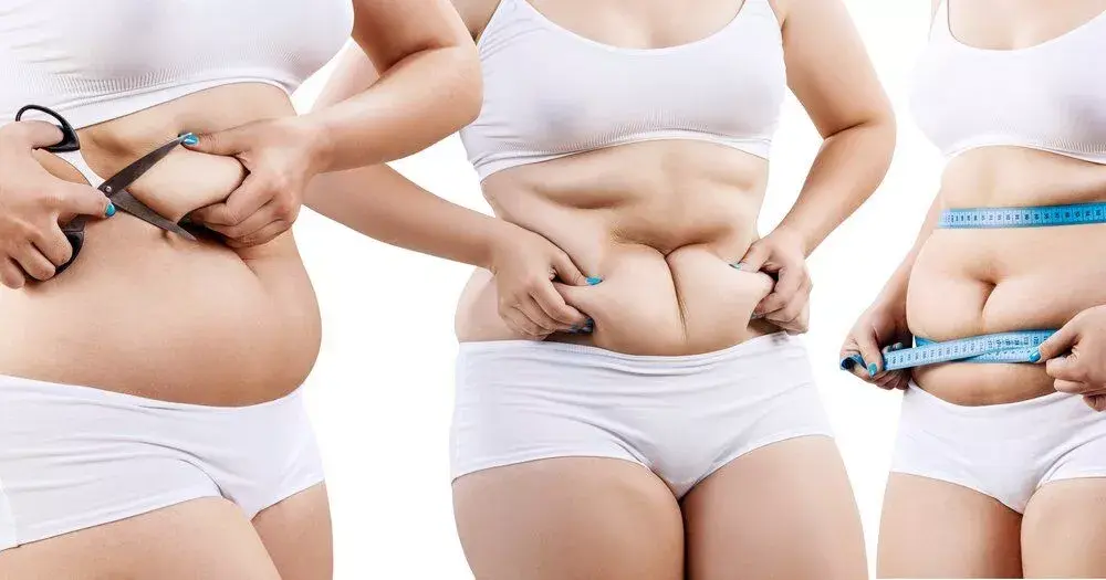 Ожирение / полнота / избыточный вес!!!