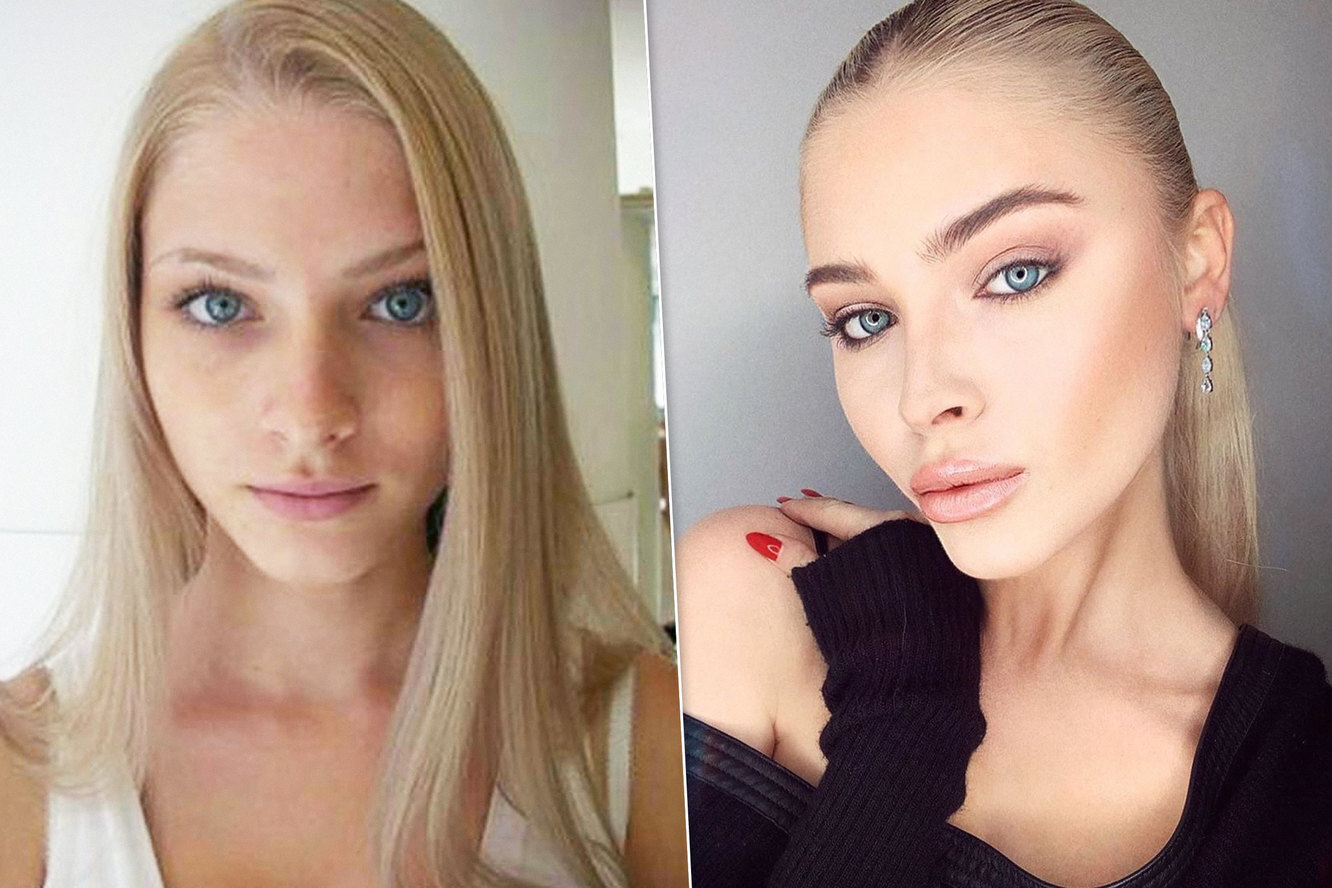 Почему многие люди решаются на пластические операции?