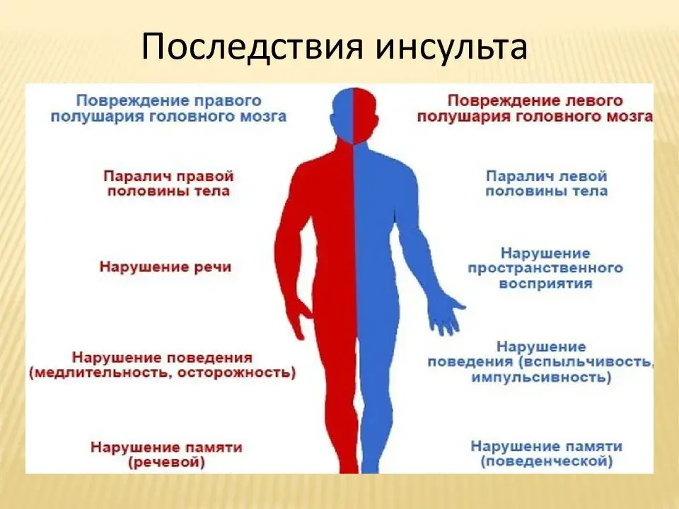 Психологические последствия инсульта презентация