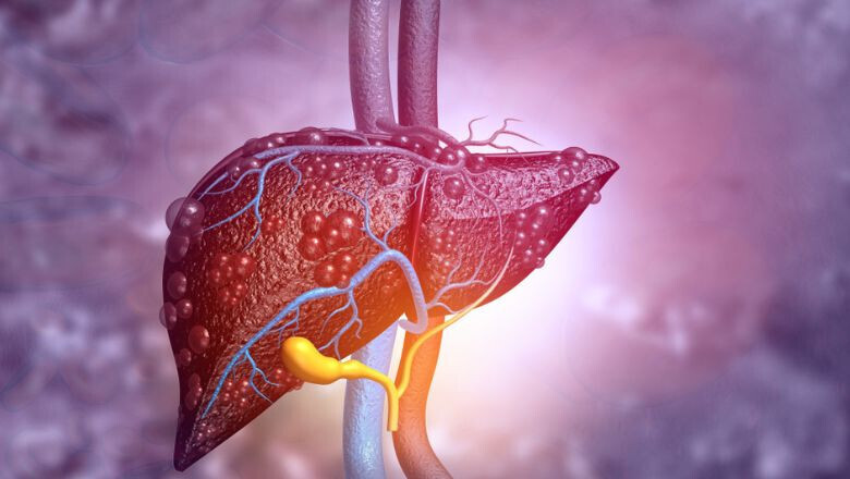 Тяжелые осложнения, которые могут возникнуть из-за жировой болезни печени