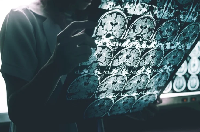 Терапевтический кетоз при легком когнитивном расстройстве, болезнях Альцгеймера и Паркинсона