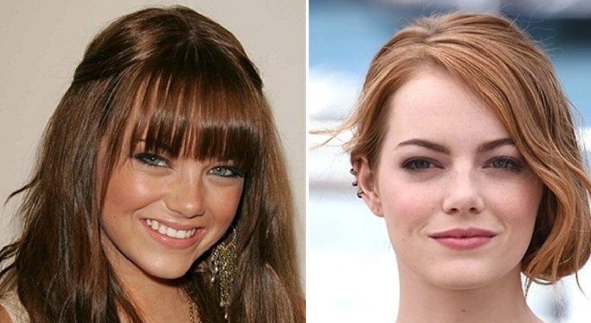 Лицо со шрамом: Знаменитости с дефектами внешности