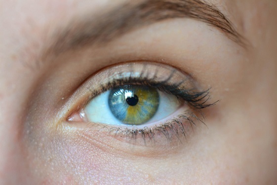 Что такое частичная гетерохромия обоих глаз?