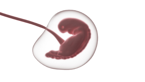 Из мозга годовалой девочки удалили нерожденного близнеца.