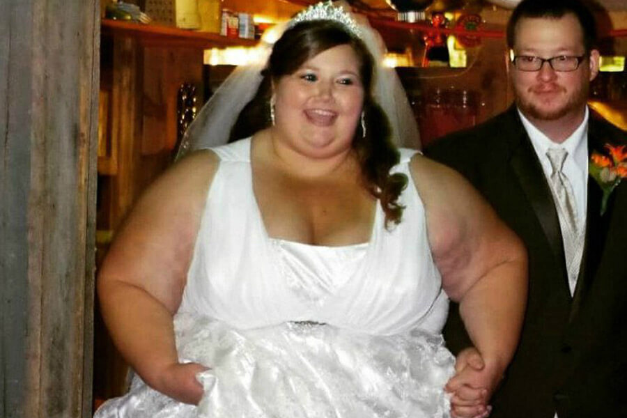 Эта Пара Чувствовала Себя В Ловушке Своих Тел, Пока Они Не Внесли Эти Невероятные Изменения В Свой Образ Жизни