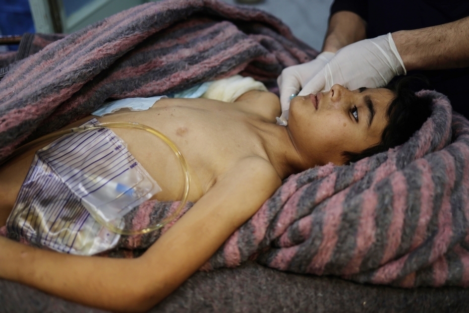 Голод, нищета, холера: жуткие будни Сирии при Башаре Асаде