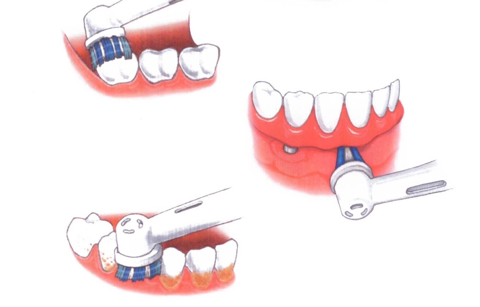 10 лучших электрических зубных щеток, которые сохраняют зубы здоровыми, яркими и жемчужно-белыми