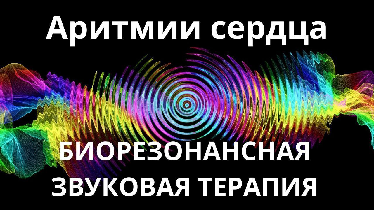 Аритмии сердца