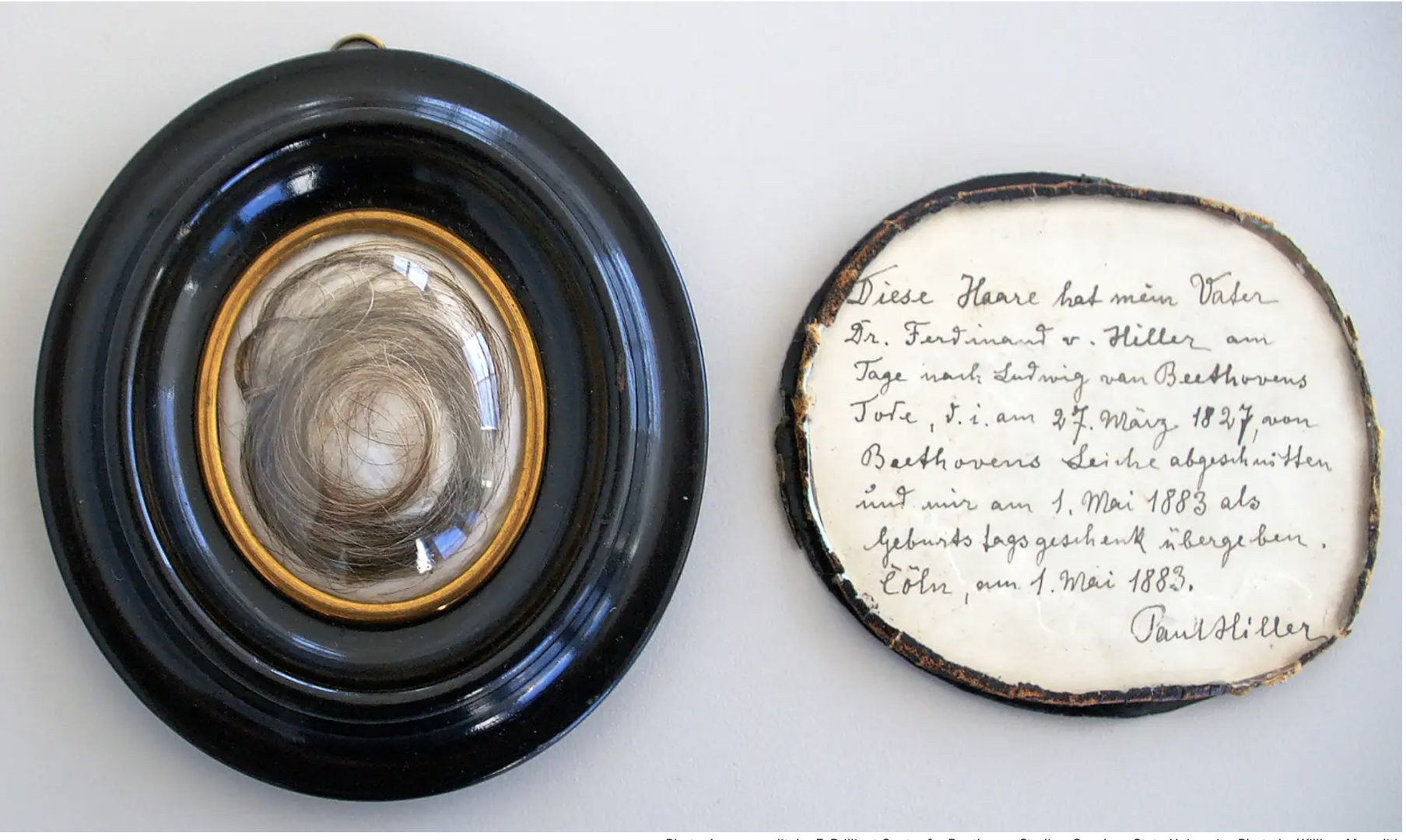 Геном Бетховена раскрывает тайны его плохого здоровья и ранней смерти