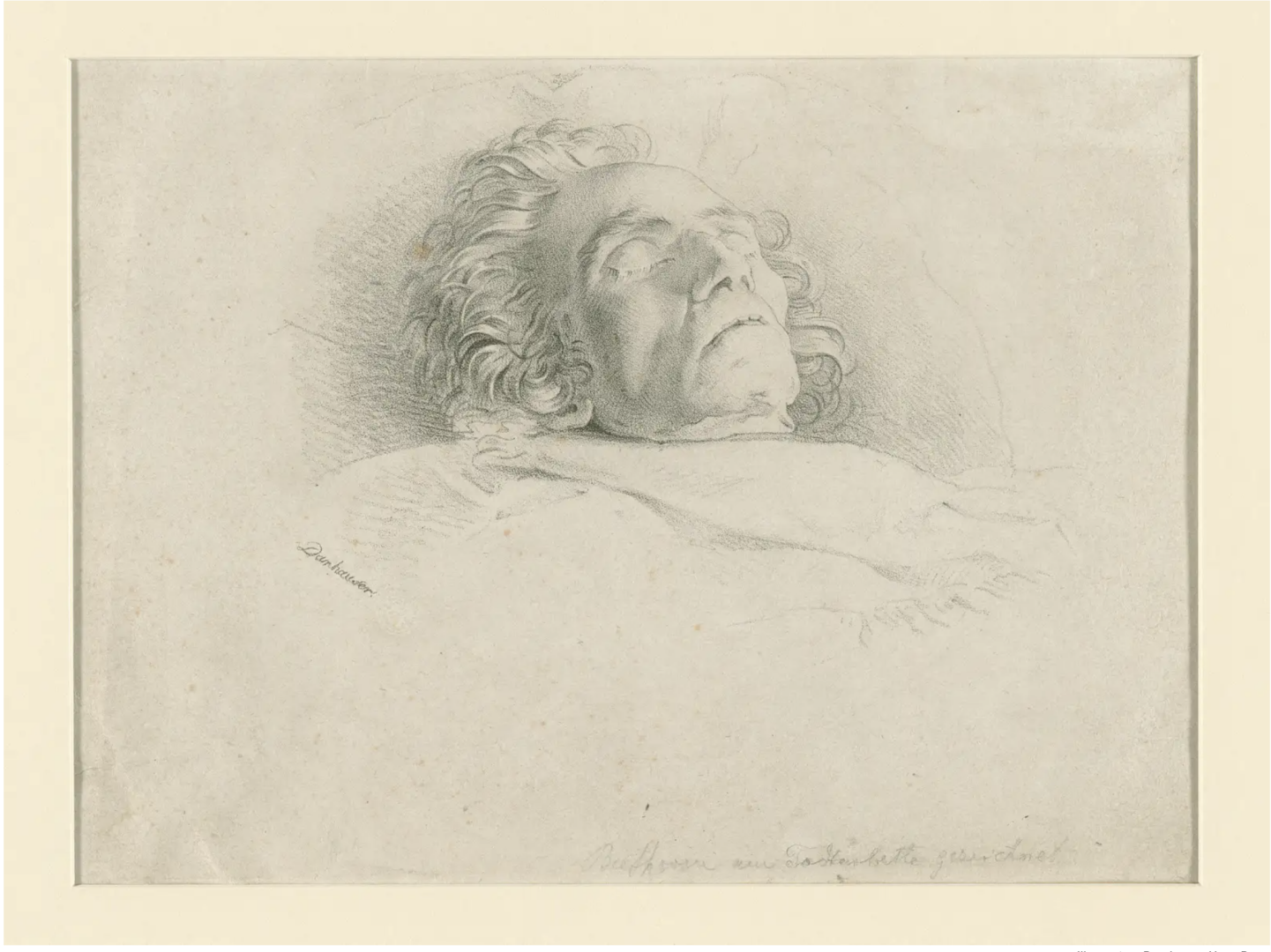 Геном Бетховена раскрывает тайны его плохого здоровья и ранней смерти