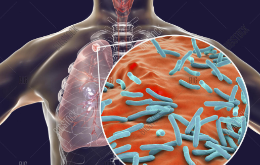 Слёзы нищеты. Величайшее открытие Роберта Коха.