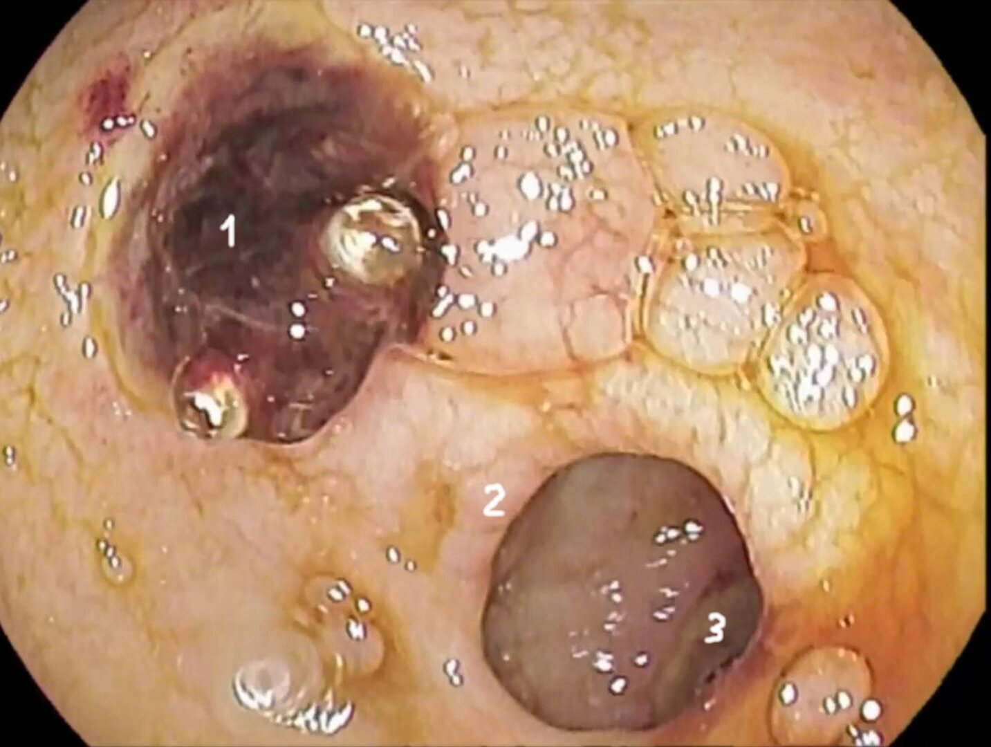 Боитесь гастроскопии?! Не её вам нужно бояться!!!