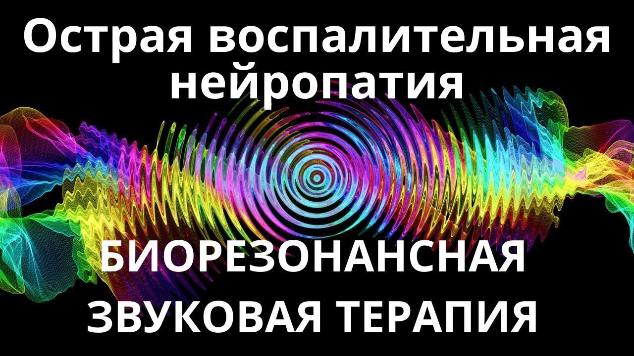 Острая воспалительная нейропатия