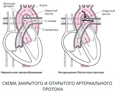 Врожденный порок сердца. От диагноза до операции!