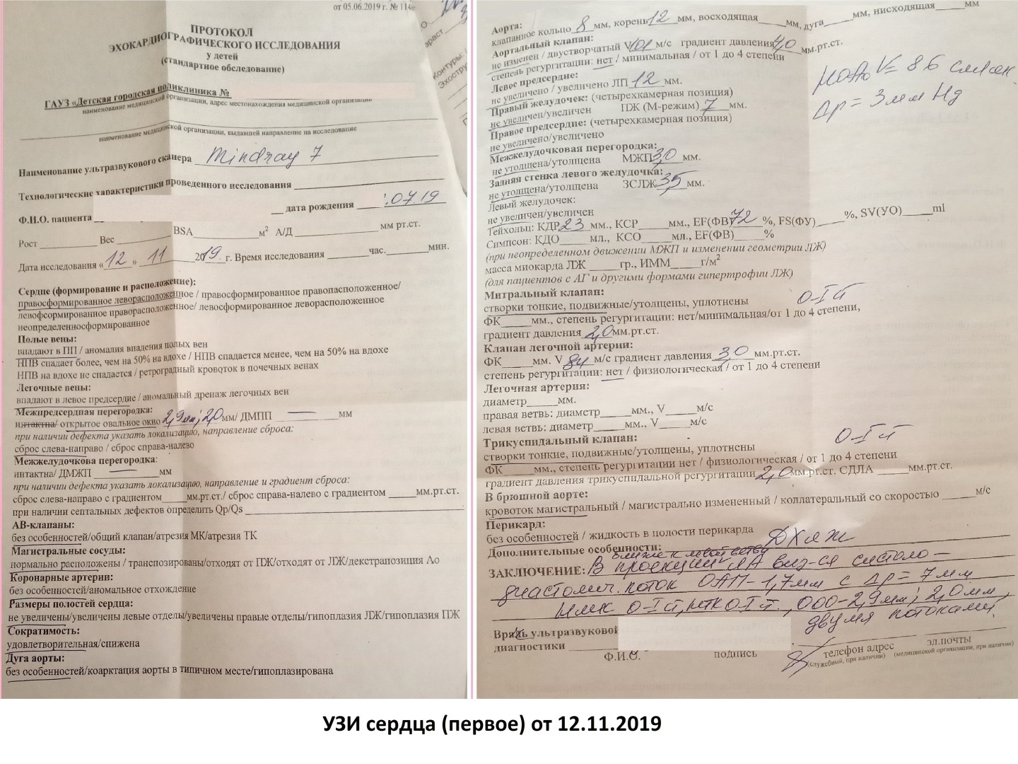 Врожденный порок сердца. От диагноза до операции!