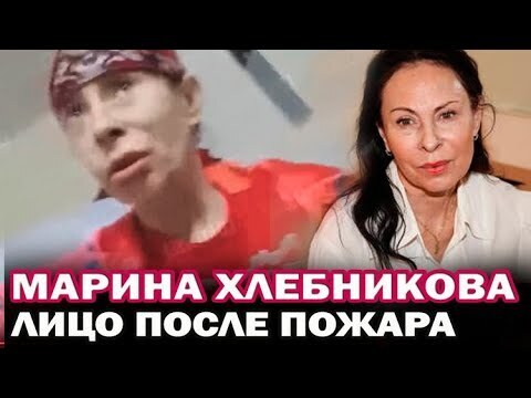 Как выглядит хлебникова после пожара фото сейчас