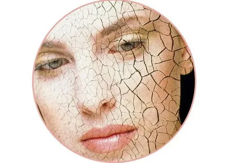 Возрастные аспекты старения кожи лица. Вечно молодой...