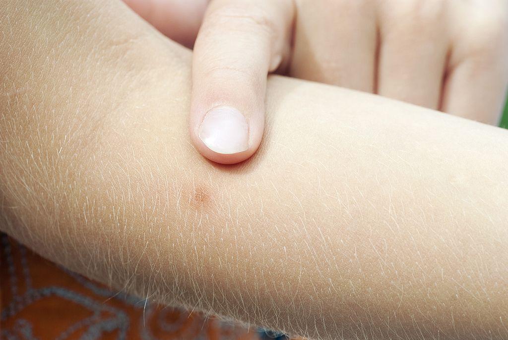 Невероятные вещи, которые можно сделать с помощью пищевой соды.