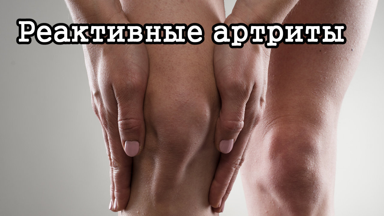 Секреты здоровья суставов при артрите: как облегчить боль и улучшить подвижность