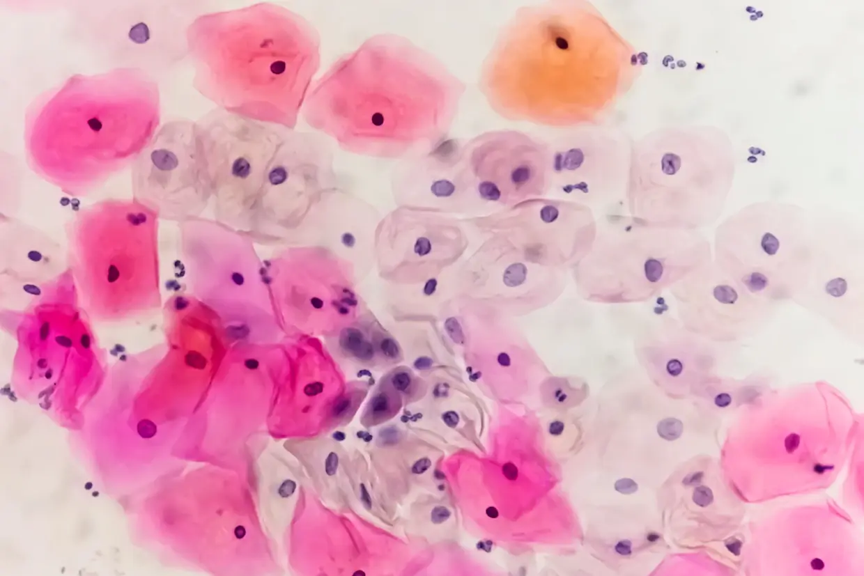 ВПЧ может вызывать множество видов рака, но многие люди этого не осознают.