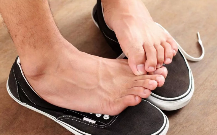 Ноги потеть больше не будут! Как избавиться от потливости ног в домашних условиях