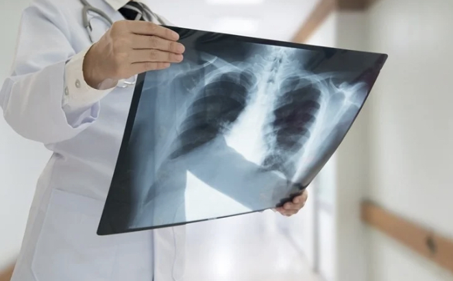 Понимание хронического кашля: причины, симптомы и диагностика.