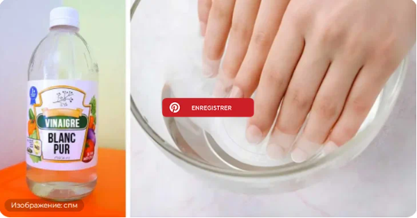Как иметь здоровые и красивые ногти с помощью уксуса?
