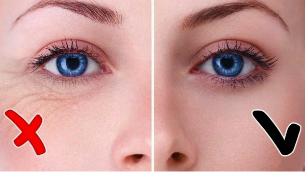 Как использовать лимон и вазелин, чтобы убрать морщины?