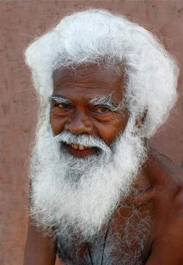 Может ли человек поседеть от сильного потрясения за несколько часов?