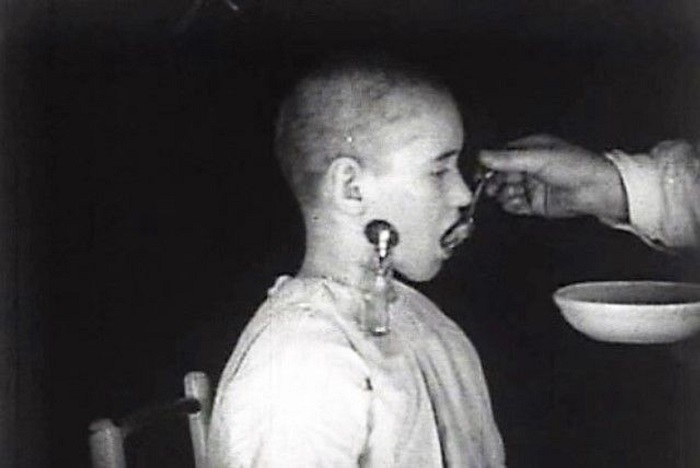 Эксперименты в СССР: от оплодотворения обезьян человеческой спермой до оживления собачьих голов. Опрос