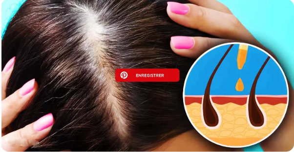 4 трюка, чтобы разбудить рост волос. Красота и здоровье.