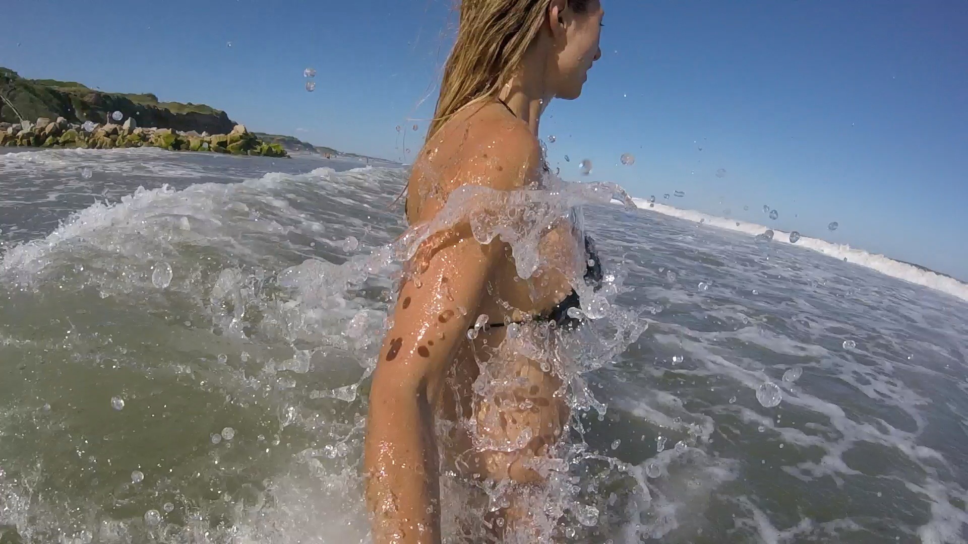 В чем опасность обильной потливости