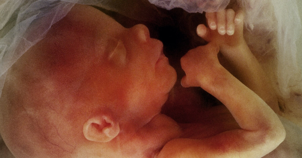 Америкосские нелюди обезумели до того что, Министерство здравоохранения США впервые одобрило внутриутробную трансгендерную хирургию.