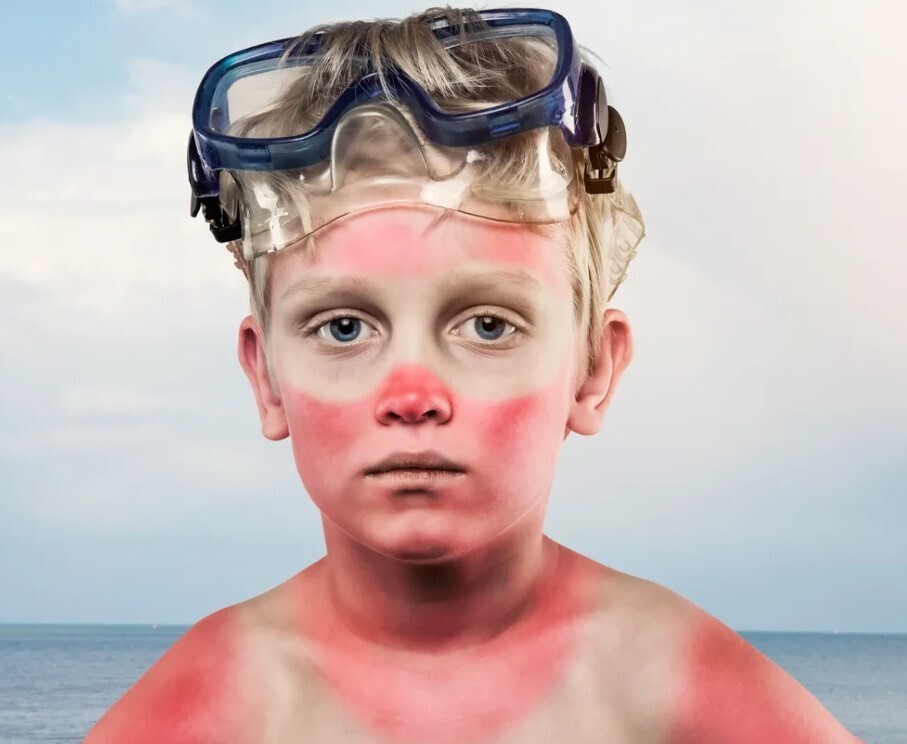 Почему некоторые люди быстро загорают, а другие быстро обгорают?