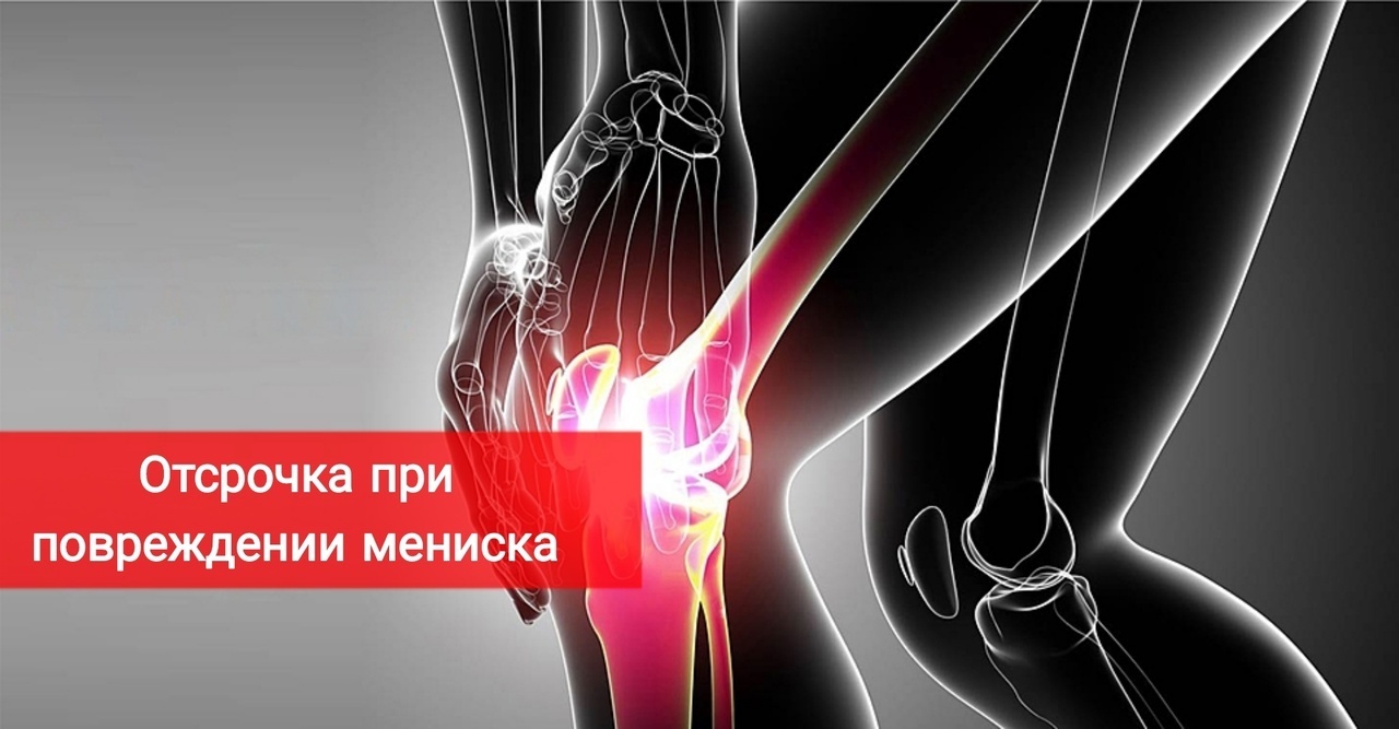Отсрочка от армии при повреждении менисков