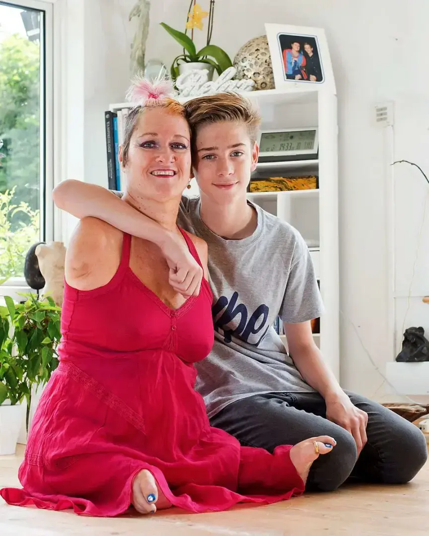 Ошибка фармацевтов 60 лет назад стала причиной тысячи изуродованных жизней