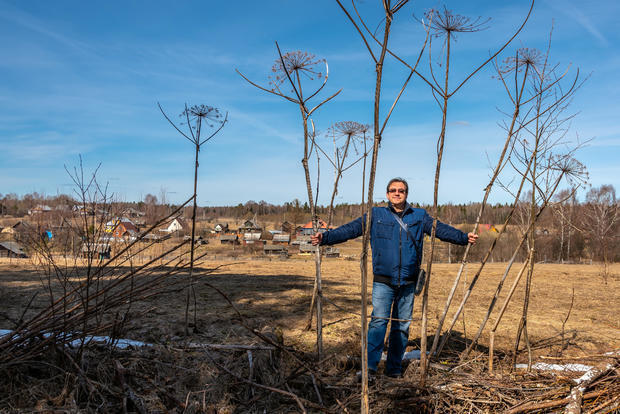 Эти гигантские красивые цветы могут оставить у вас ожоги, волдыри и шрамы на всю жизнь. Вот что нужно знать о борщевике гигантском.