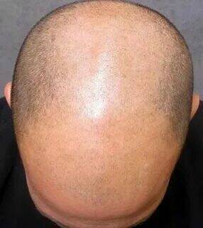 Почему женщинам нравятся лысые мужчины.