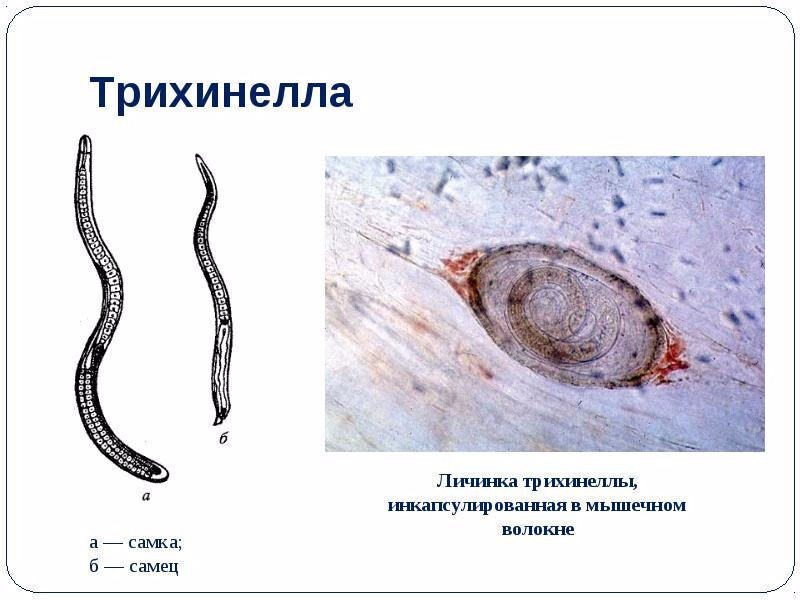 Грозный паразит: Трихинеллез в диком мясе забайкальского медведя