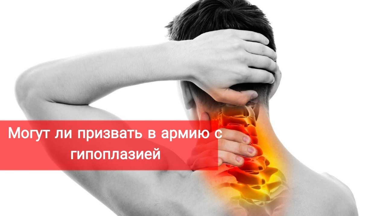 Могут ли призвать в армию с гипоплазией