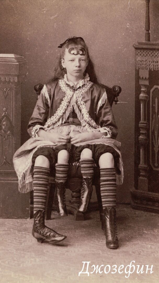 Джозефин Миртл Корбин: 4 факта о четырехногой женщине, которые вызывают шок