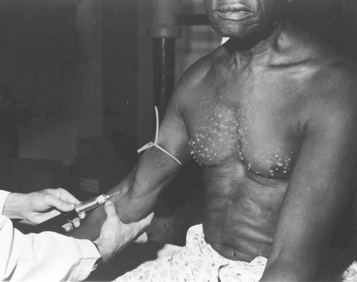 Медицинский скандал 1972 года: Эксперименты в Институте Таскиги и их социальные последствия