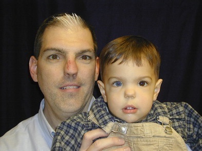 Патология, которая делает людей привлекательными, или Трагическая красота