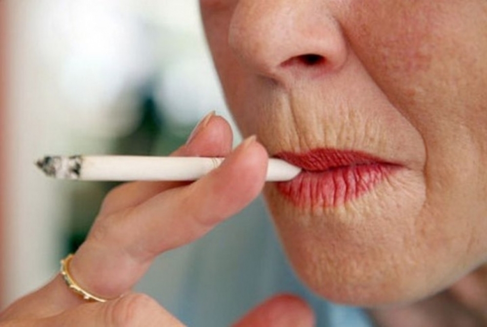 Кисетные морщины или морщины курильщика: как от них избавиться и каковы пути их перехода в глубокие морщины на верхней губе с годами.